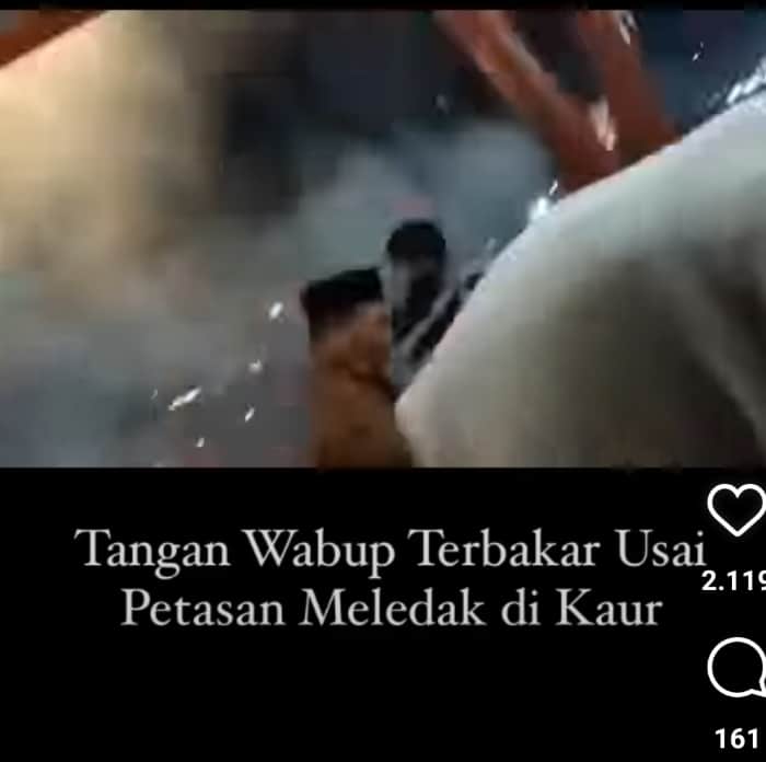 Video Dua Jari Wakil Bupati Bengkulu Putus Karena Petasan Viral Video Dua Jari Wakil Bupati Bengkulu Putus Karena Petasan Viral