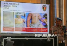 Komnas HAM Panggil Jajaran Polda Metro Jaya soal Kasus Penyiraman Aktivis Kontras, Ini Hasilnya